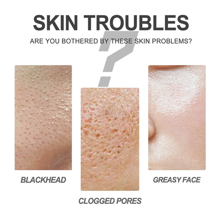 Nose Blackhead Removal Mask Deep Cleansing Skin Care Blackhead
