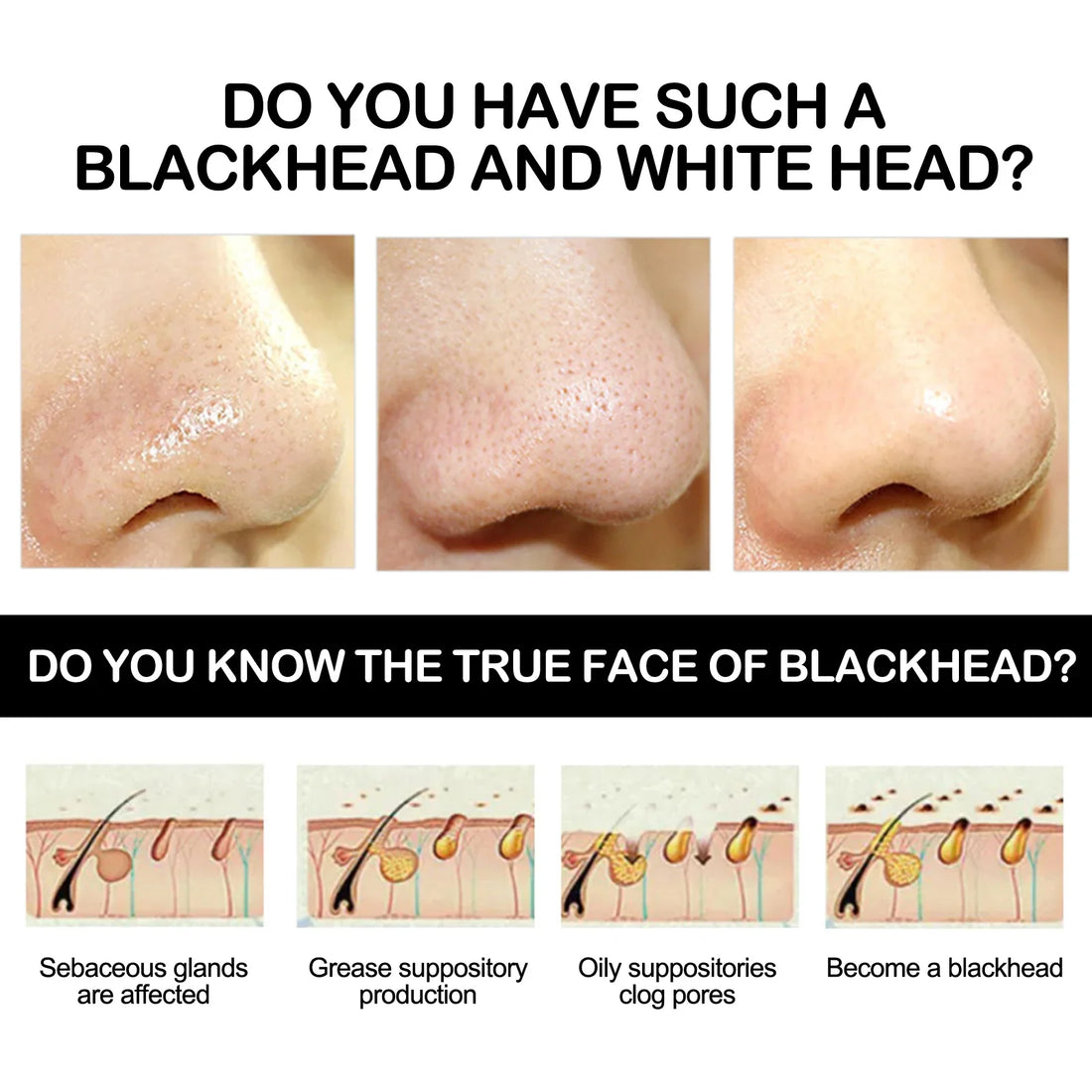 Bamboo Charcoal Cleansing Mask Blackhead Acne Mud Mask